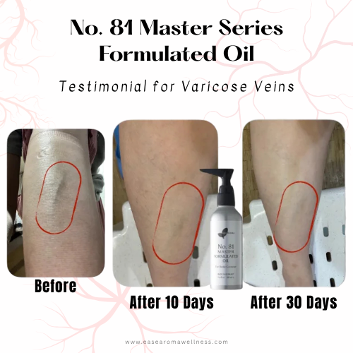 Easearoma Master Series No. 81 For Body Contour Formulated Oil 100ml Premium Essential Oil German Aromatherapy