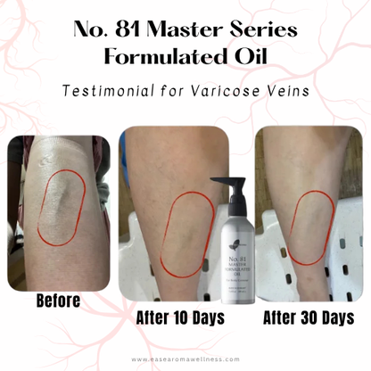 Easearoma Master Series No. 81 For Body Contour Formulated Oil 100ml Premium Essential Oil German Aromatherapy